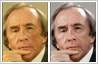 Photo editing example [Blemish removal]: A four-inch long surgical scar needs to be removed from Sir Jackie Stewart's face.