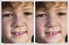 Photo editing example [Blemish removal]: The boy's face needs to be cleared of freckles.