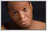 Vitiligo (leucoderma) patches removed with photo editing