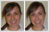 View 'before' and 'after' pics. The photo of this young female intern has been retouched to reshape and enhance facial features. Blemishes on face have been removed.