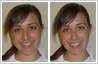 View 'before' and 'after' pics. The photo of this young female intern has been retouched to reshape and enhance facial features. Blemishes on face have been removed.