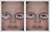 Eyeglass glare fixed in little boy's spectacles