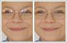 Eyeglass Glare Removal