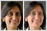Dark circles under eyes removed with photo retouching. Age reduction with photo editing.