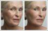 Photo retouching to remove wrinkles, and skin firming. See how much younger this lady looks after editing.