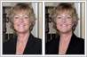 Wrinkle removal and face lift with photo retouching. Woman in her 50s made to look younger.