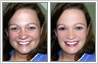 Photo retouching used to remove marks from woman's face and add make-up & glamour