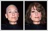 Bald actress Judith Light, make to wear a wig with photo editing