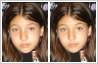 Red eye correction