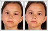Photo editing eye correction services