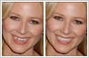 Photo editing example of teeth correction. Teeth gaps and crooked teeth have been fixed.