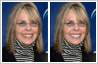 Diane Keaton's discoloured teeth have been bleached / cleaned / whitened