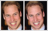 Have whiter teeth with photo retouching. Teeth whitening 'before' and 'after' photos.