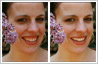 Excessively visible gums corrected with photo editing