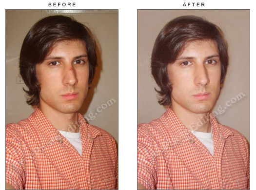 Photo editing: Boil on young man's nose has been retouched, and photograph generally enhanced. On left is the boy's photograph before editing.