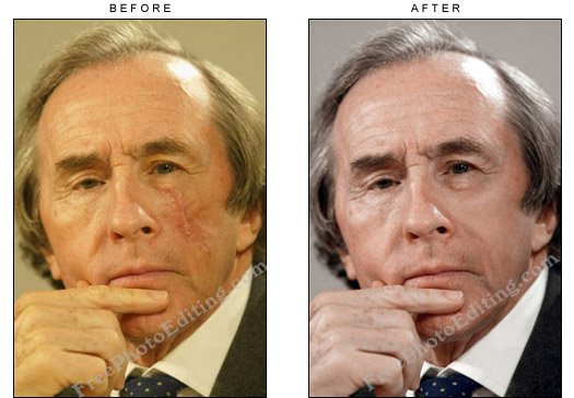 Photo editing: The surgical scar on Sir Jackie Stewart's face has been edited. On left is the same photograph before photo editing.