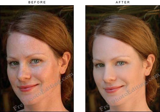 After photo retouching: Freckles removed