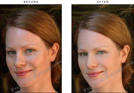 After photo retouching: Freckles removed