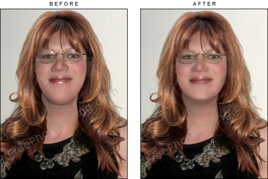 This is a photo editing example in which a person's large chin has been reduced and reshaped virtually with the help of photo retouching.