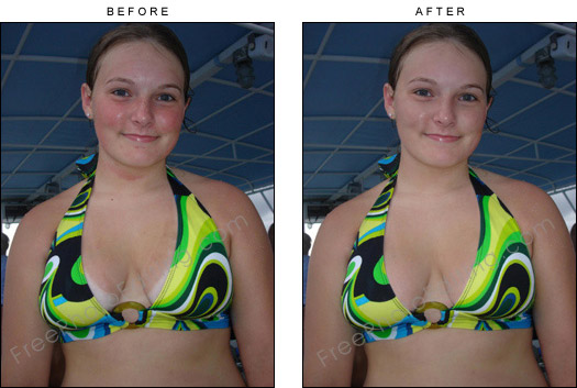 This is a photo retouching example of sunburn removal and tan lines removal.