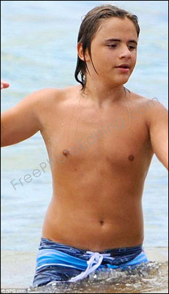 This is a photo retouching example of fixing vitiligo patches digitally. The original photo can be seen on left.