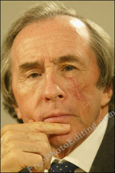 Photo editing example [Blemish removal]: This photograph shows a long surgical scar on the left side of Sir Jackie Stewart's face, which needs to be touched up. 