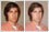 Photo editing example [Blemish removal]: A pimple (or is it a boil?) needs to be retouched on the boy's face and the photo generally enhanced.