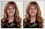 Do a trial chin reshaping (large chin reduction) with photo retouching. 