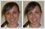 View 'before' and 'after' pics. The photo of this young female intern has been retouched to reshape and enhance facial features. Blemishes on face have been removed.