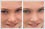 View eye colour change after photo edit