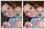 Colour correction to restore healthy skin tone to subjects' compelxion