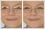 Eyeglass Glare Removal