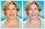 Plus-size woman looks thinner with after photo retouching and photo editing.