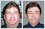 This is a photo editing sample in which an overweight man has been made to look thin. Fat on face and neck has been removed and the subject has been slimmed down.