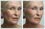 Photo retouching to remove wrinkles, and skin firming. See how much younger this lady looks after editing.
