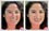 Digital photo retouching to look younger. Rash on face edited; squinchy eyes opened up; mae-up added