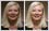 Look younger than your years with photo retouching.