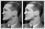 Digital nose job on boxer Fritzie Zivic's broken nose