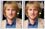 Owen Wilson's crooked, broken nose has been fixed with photo editng