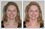 Beauty retouching: Ordinary looking woman transformed into a glamourous model with photo retouching and enhancement