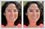 Woman's squinchy eyes fixed with photo editing; half-closed eyes have been opened
