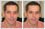 This is a photo editing example of squinchy eye correction. The subject's eyes seem only half open and shrunken. In fact, one eye is more squinched than the other. See 'before' and 'after' photos.