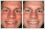 Photo editing used to repair / reconstruct chipped or broken teeth (digital dentistry).