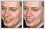 Photo retouching required to fix Steve Buscemi's snaggle tooth, and make it the same size as his other teeth