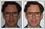 Crooked, lop-sided smile has been fixed with photo editing.