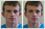 We offer photo retouching services to fix abnormalities and deformities.