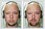 Add facial hair with photo editing. Have thicker moustache and denser beard.