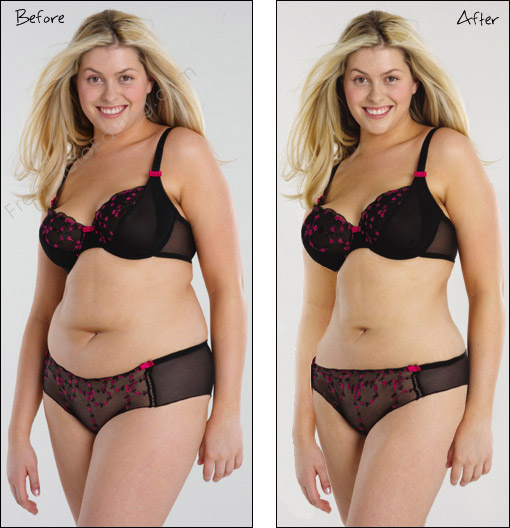 This is a photo editing example in which a woman with excessive abdominal fat has been slimmed down with a tummy tuck. The fat has been absorbed with photo editing magic. Surgical liposuction is not required.