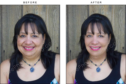 This is a photo editing example in which a middle-aged woman has been made to look younger. Blemishes on the face have been touched up; under-eye bags have been retouched; extra fat on the face has been removed. Original unedited photo can be seen on left.