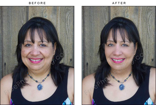 This is a photo editing example in which a middle-aged woman has been made to look younger. Blemishes on the face have been touched up; under-eye bags have been retouched; extra fat on the face has been removed. Original unedited photo can be seen on left.